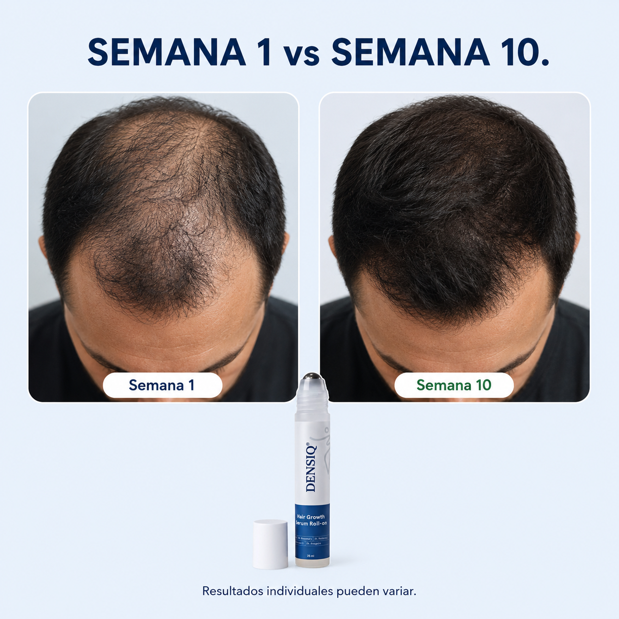 DENSIQ® Sérum Roll-on para Cabello