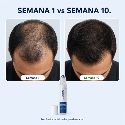 DENSIQ® Sérum Roll-on para Cabello